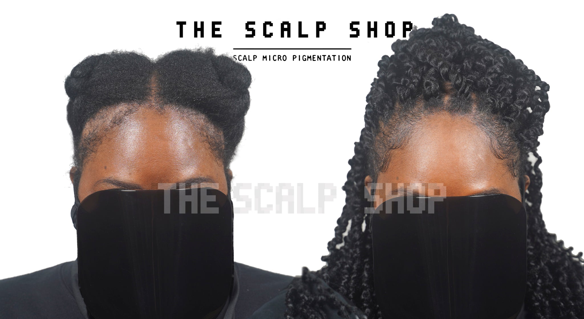 Scalp Micropigmentation (SMP) Hair Loss Treatment Non-Refundable Deposit - 2 Session Package